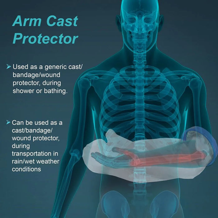Tynor Cast Cover (Arm)